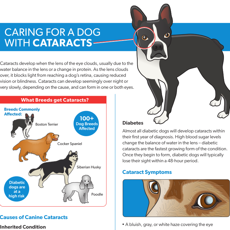 Cataracts Resource Guide Preview